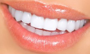 ¿Cómo mantener los dientes blancos?